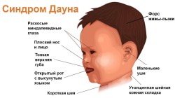JPG Image, 109KB, 1282px × 720px