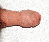 GIF Image, 465KB, 483px × 408px